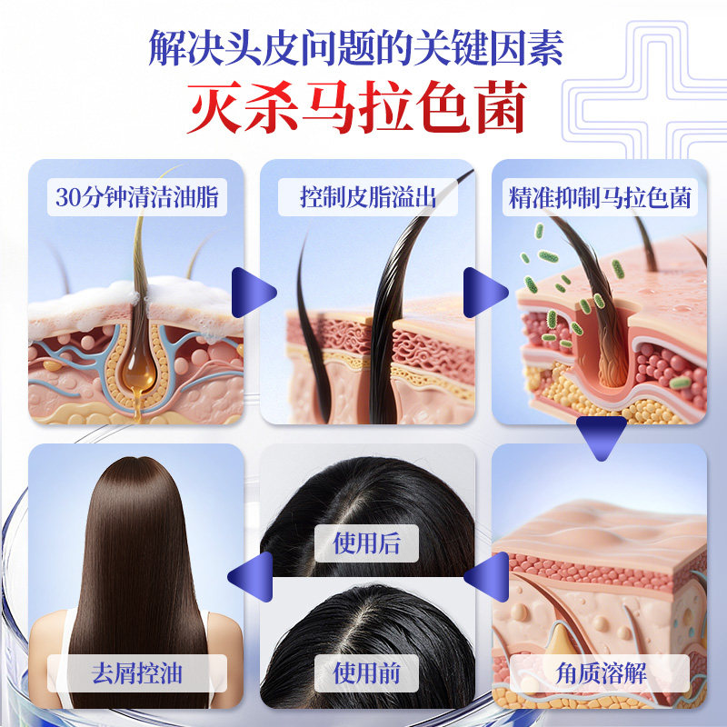 采乐二硫化硒洗发水双重去屑止痒洗发液控油保湿蓬松洗发露旅行装,淘宝优惠券,粉丝福利购,淘宝优惠卷