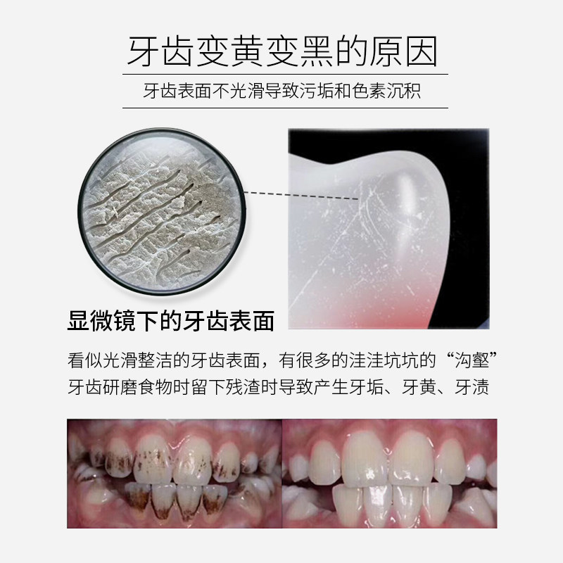 dr . wild瑞士进口怀尔德抛光牙膏 怀尔德牙膏