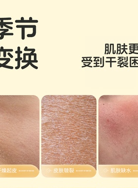sakose凡士林马油干裂棒