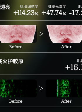 俊平龙井茶萃精华油15ml敏感肌