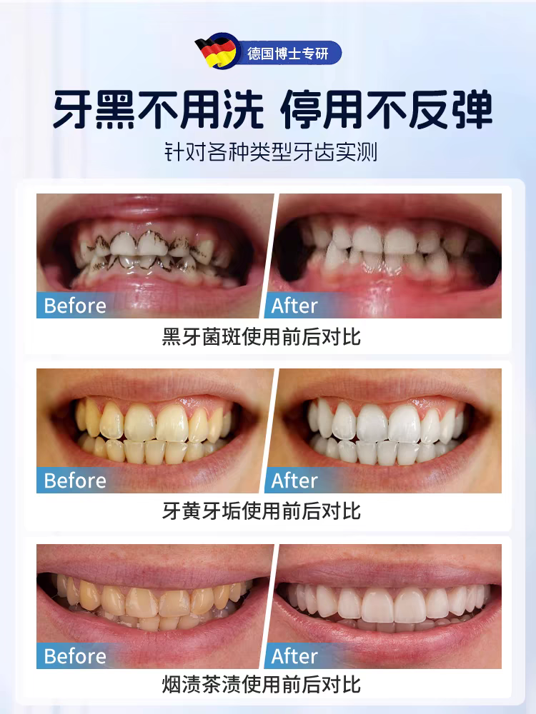 【牙齿橡皮擦】德国黑科技-牙黄亮白-安全无害-一擦洁净 - 图1