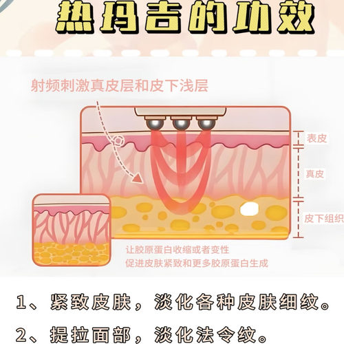 360度水光仪美容仪器脸部提拉紧致除皱波拉皮吉脸拉提瘦脸热玛 - 图1