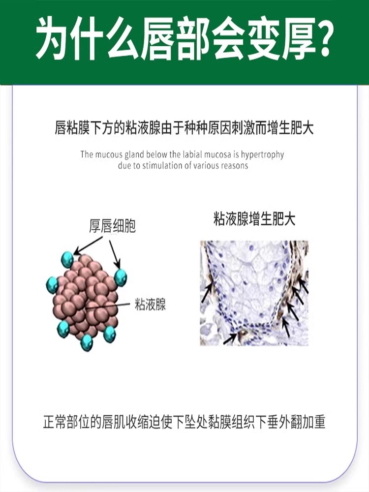 缩小厚嘴唇变薄神器变小外翻矫正改善嘴凸唇周黑黑色素去除闭合贴 - 图0