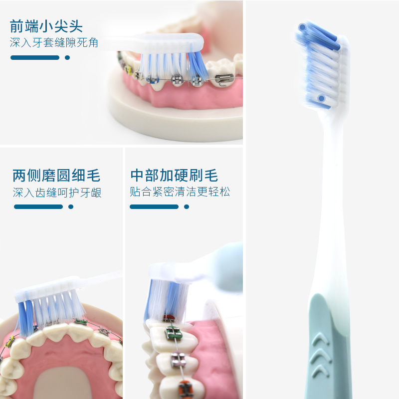 日本丹特博凹凸型软毛小头正畸牙刷矫正牙齿箍牙套专用牙刷2支装-图0