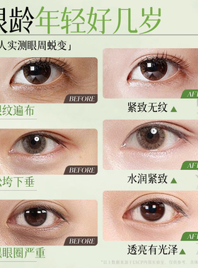 【以油养眼】紧致淡纹滚珠精油