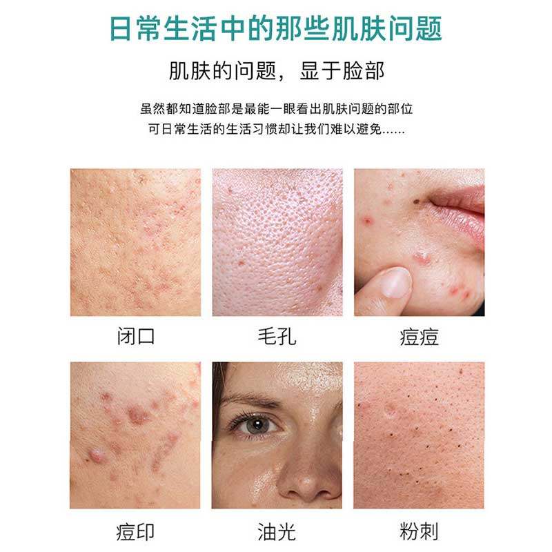 水杨酸软膏软化角质凝胶15尿素乳膏正品医用官方旗舰店抑菌高浓度,淘宝优惠券,粉丝福利购,淘宝优惠卷