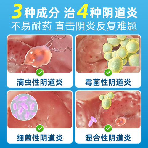 妇科用药正品甲硝唑栓塞凝胶阴道炎抑菌霉菌细菌性阴道片甲硝锉铨 - 图2