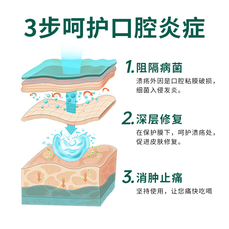 南京同仁堂口腔溃疡专用喷剂消炎肿牙龈出血西瓜霜喷雾医用含漱液-图2