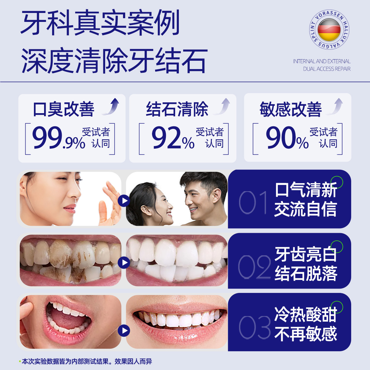 医用去除牙结石牙膏去黄口臭美白专用溶解牙菌斑牙渍牙垢黄牙速效 - 图0