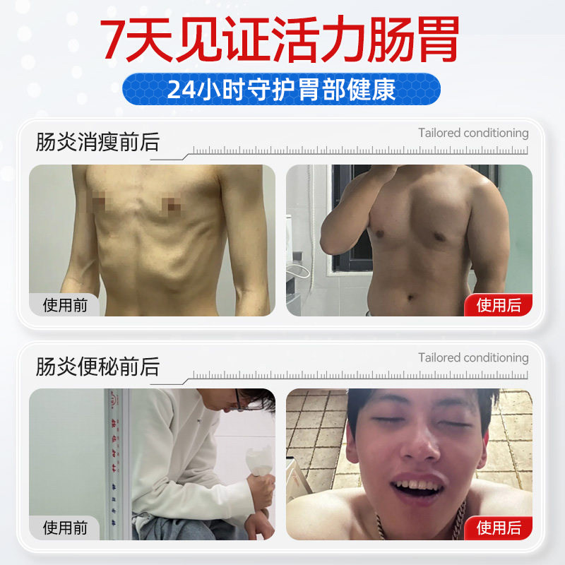 【邦院长】远红外肠胃贴调理胃痛胃胀腹痛胃炎消化不良理疗暖胃贴,淘宝优惠券,粉丝福利购,淘宝优惠卷