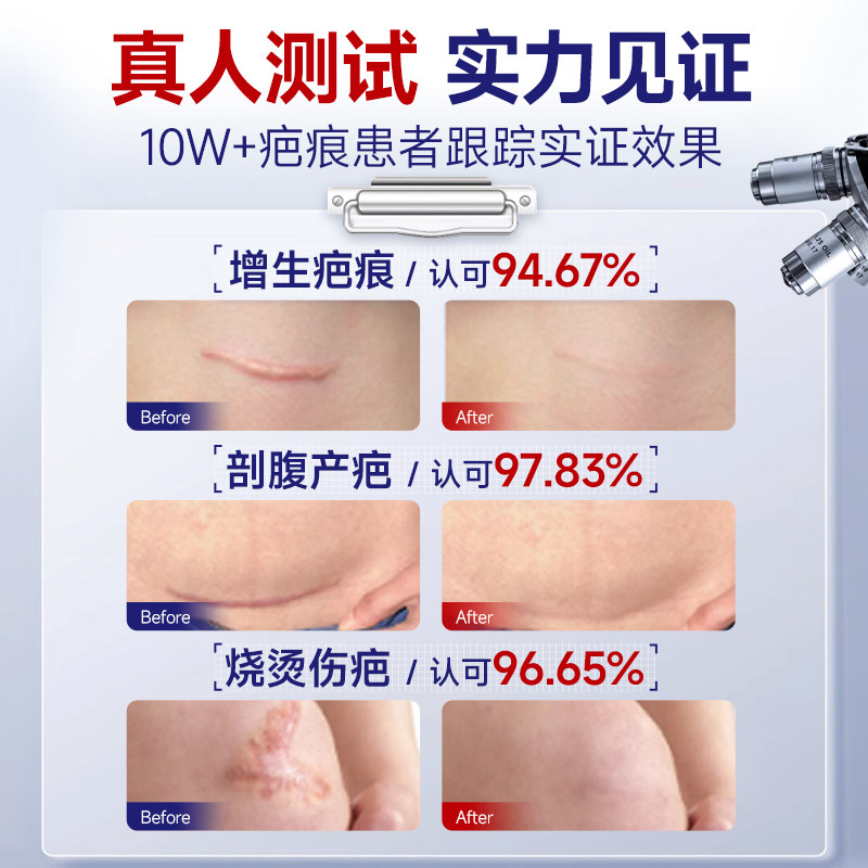 疤痕贴剖腹产增生凸起去除疙瘩修复减张隐形医用硅酮凝胶祛疤贴膏