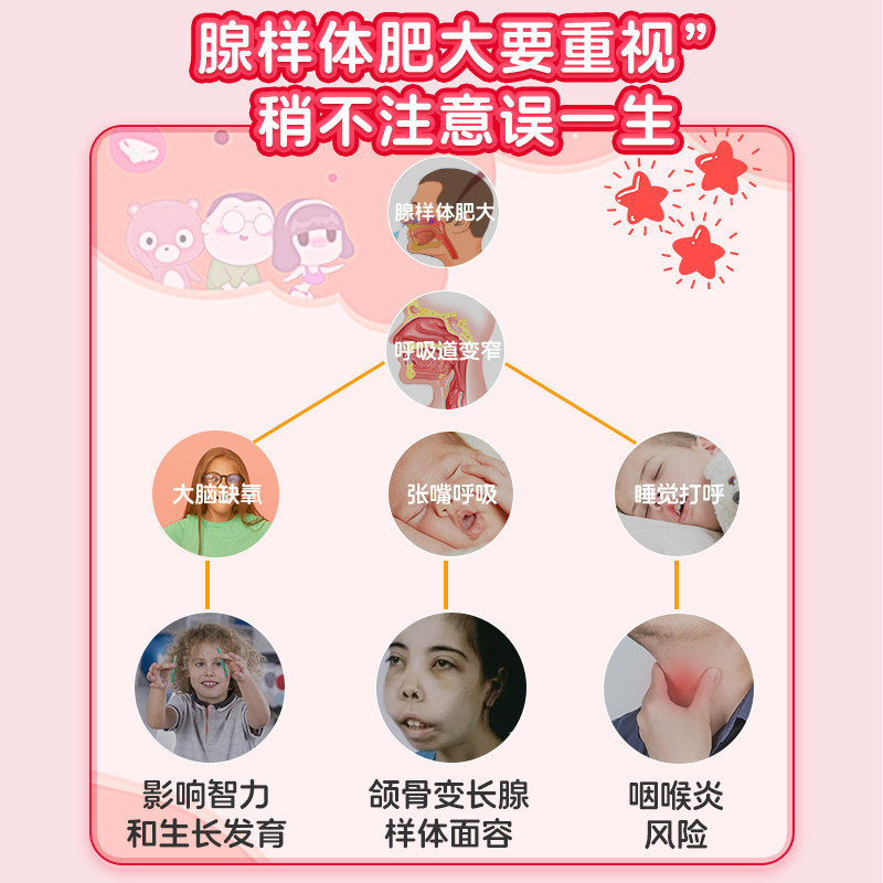 葵花儿童腺样体肥大贴面容扁桃体肿大矫正器中药贴睡觉打呼噜调理