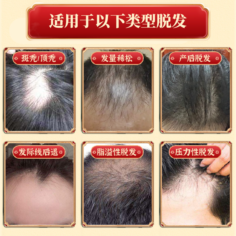 百会生发片何首乌养血生发丸胶囊补肝益肾斑秃脂溢补肾防脱发白发,淘宝优惠券,粉丝福利购,淘宝优惠卷