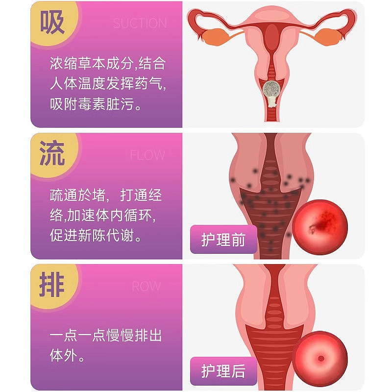中药妇科清宫丸正品拉线排脏私密抑菌保养女性子宫养巢私处护理丹,淘宝优惠券,粉丝福利购,淘宝优惠卷