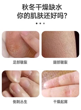 新喜乐裂可宁霜正品防裂膏护手霜女干裂手足脚后跟裂口官方旗舰店