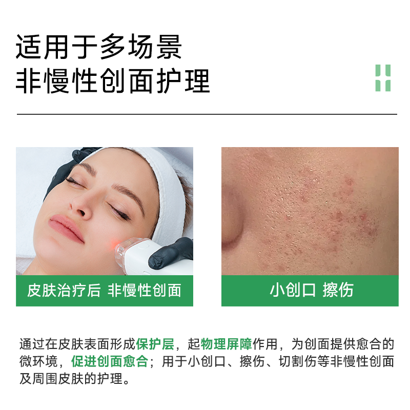 自然攻略医用重组Ⅲ型胶原蛋白修复敷料项目后创面护理械号喷雾型