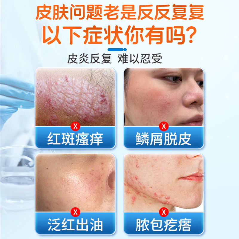 医用软膏脂溢性皮炎鼻翼面部两侧泛红痒外用止痒顽固无激素膏药,淘宝优惠券,粉丝福利购,淘宝优惠卷