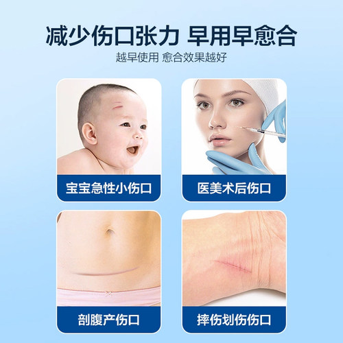 3M医用级减张贴1546甲状腺术后疤痕减张术后愈合伤口免缝减张贴 - 图2