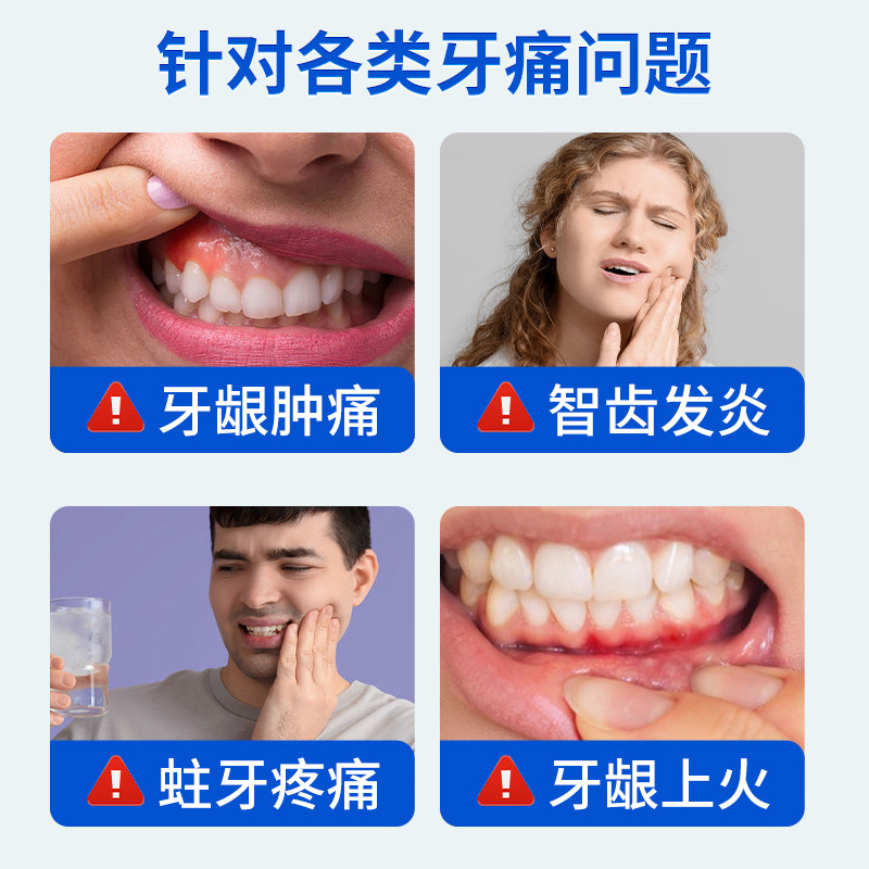 儿童牙疼牙痛止疼喷雾剂宁专用非药牙龈脓包智齿牙齿肿痛消炎上火