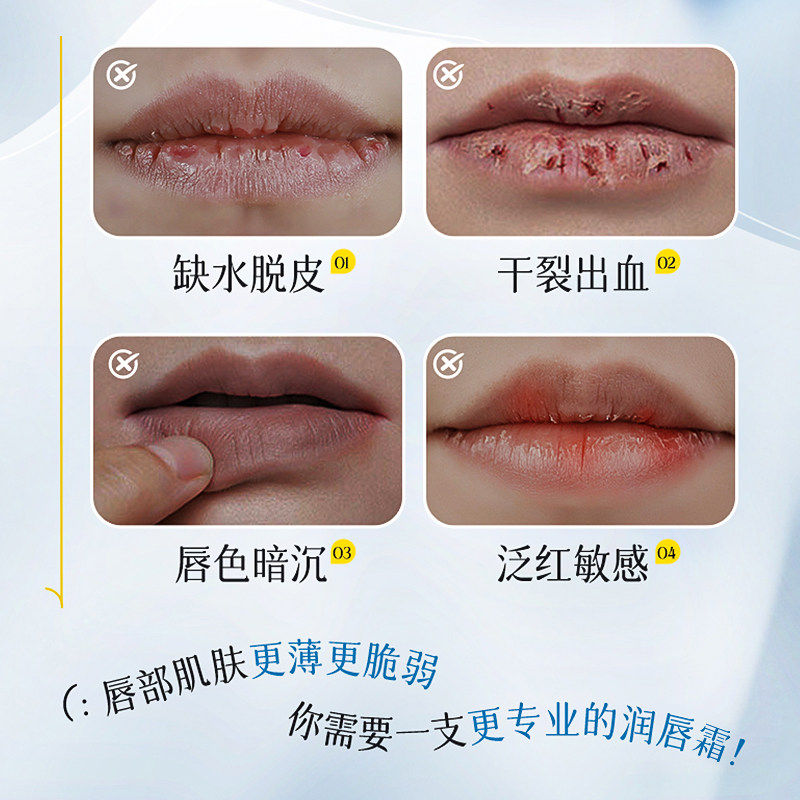 B5凡士林润唇膏补水保湿滋润去淡化唇纹死皮防干裂唇部唇炎精华女,淘宝优惠券,粉丝福利购,淘宝优惠卷