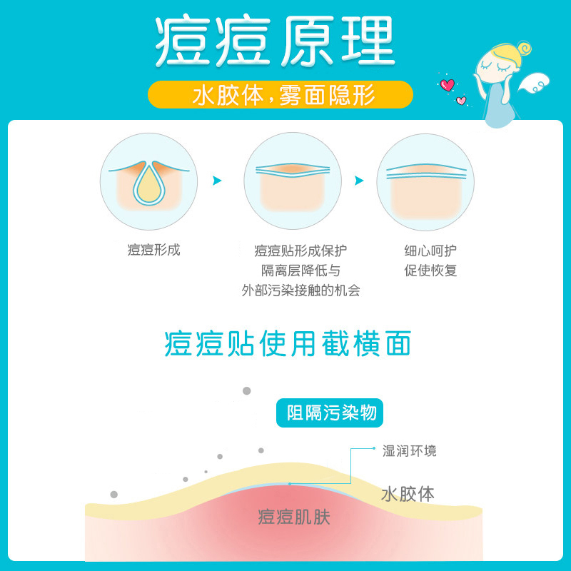 护妍天使炫彩痘痘贴遮瑕祛痘贴星星痘痘贴可爱爱心卡通轻薄透气