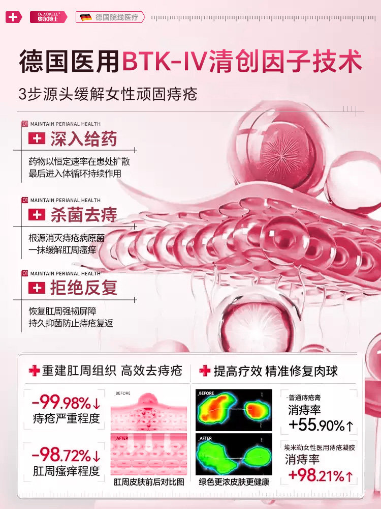 医用女性痔疮膏卡波姆消肉凝胶球混合内外痔敷料肛裂便血瘙痒正品,淘宝优惠券,粉丝福利购,淘宝优惠卷