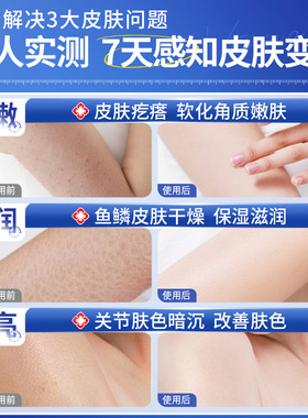 维a酸乳胶膏和尿素维e乳软膏去黑色素沉淀鸡皮疙瘩毛囊角质非医用