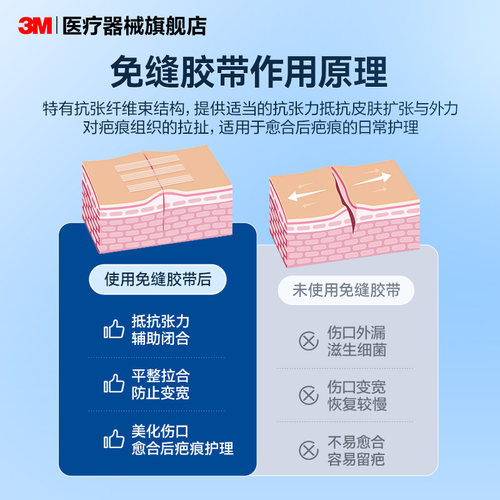 3M医用级减张贴1546甲状腺术后疤痕减张术后愈合伤口免缝减张贴 - 图0
