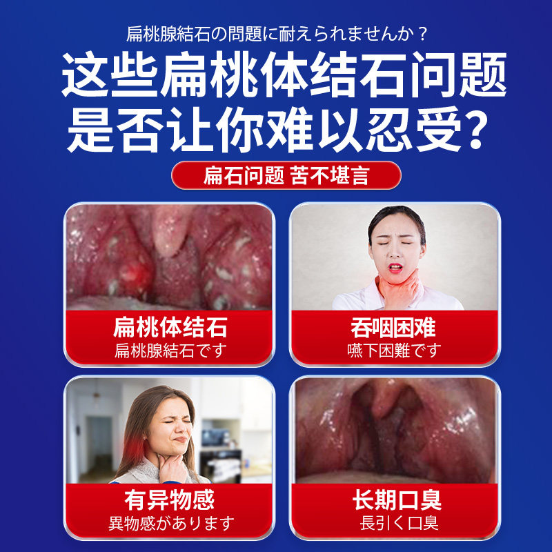 扁桃体结石去除工具喷剂隐窝冲洗器口臭漱口水非电动清洁口腔神器,淘宝优惠券,粉丝福利购,淘宝优惠卷
