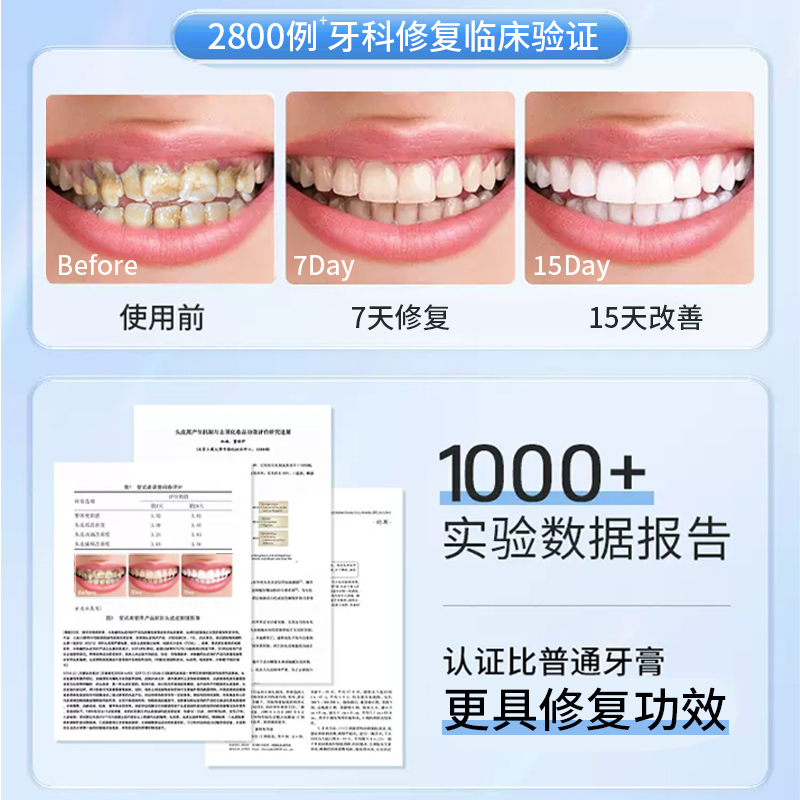 牙龈萎缩抗过敏修复专用牙膏牙周炎去牙结石祛除牙菌斑牙科分离剂