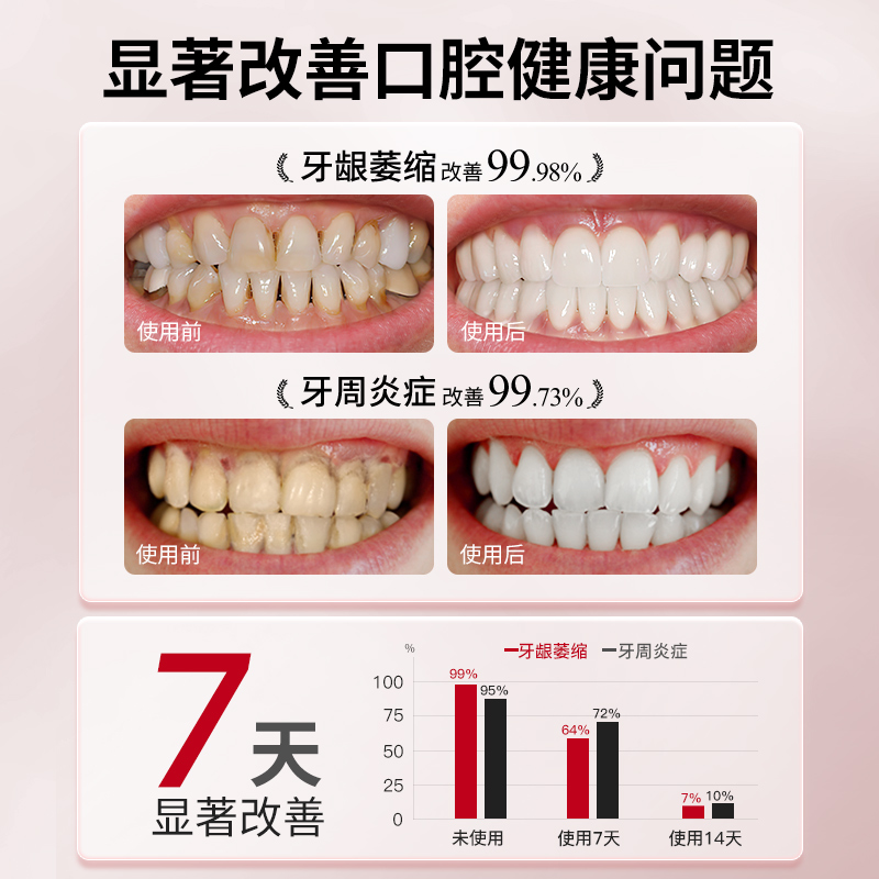 医用牙龈萎缩修复再生专用牙膏治牙周炎口腔护理脱敏膏官方旗舰店