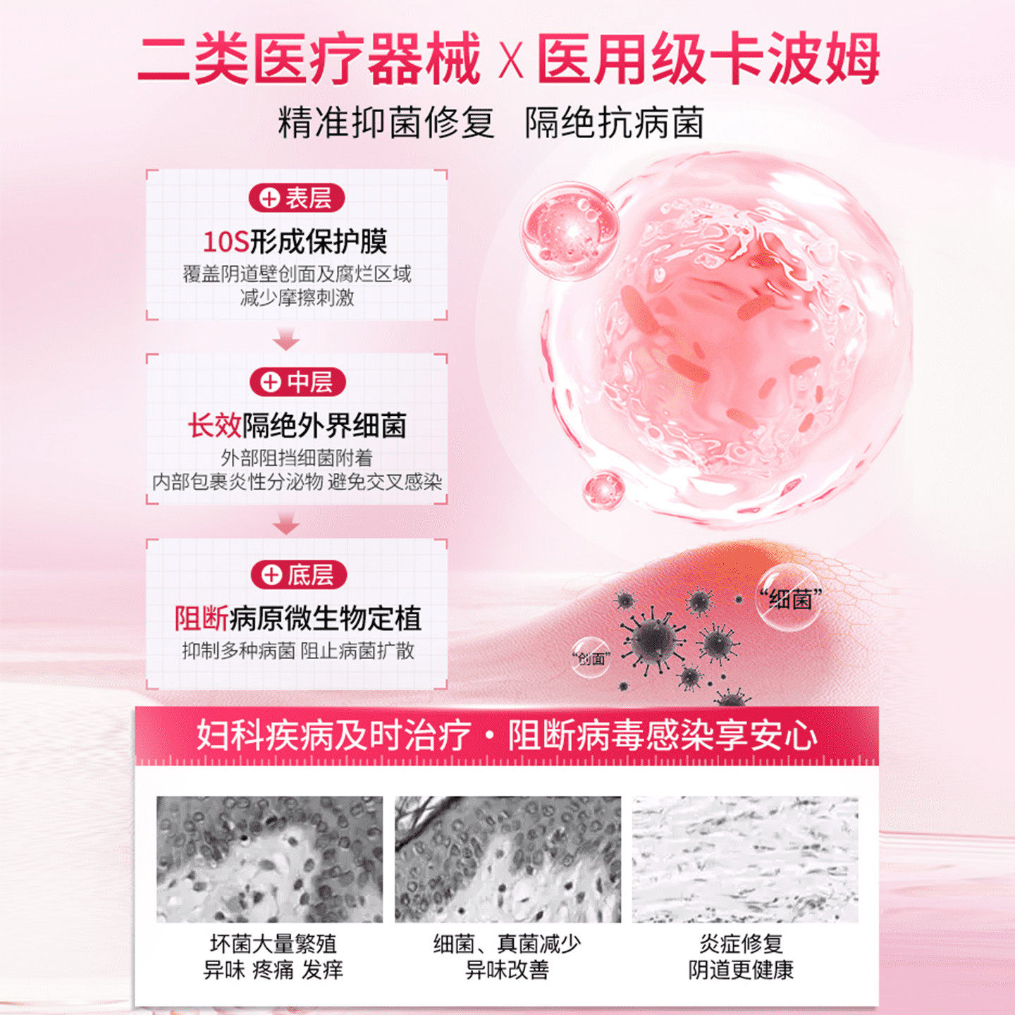 毓婷卡波姆阴道填塞凝胶阴道炎宫颈糜烂私处护理抑菌正品妇科凝胶,淘宝优惠券,粉丝福利购,淘宝优惠卷