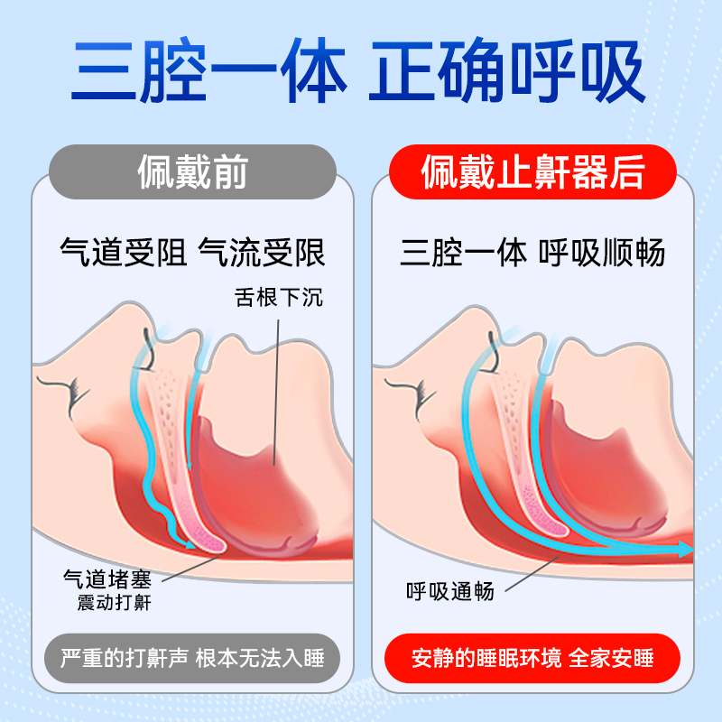 止鼾器防打呼噜鼾立停打鼾神器消专用男士女睡觉止鼾官方正品医用 - 图1