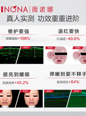 薇诺娜舒敏保湿特护精华液第二代