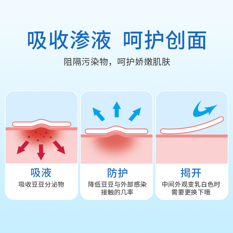 安其生痘痘贴人工皮医用水胶体敷料隐形伤口小号创可贴痘印痘贴 - 图1