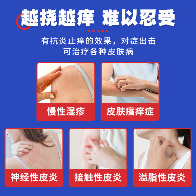 Compound dexamethasone acetate cream 20g15mg*1 tube/box chronic eczema | skin allergies | seborrheic dermatitis | dermatitis