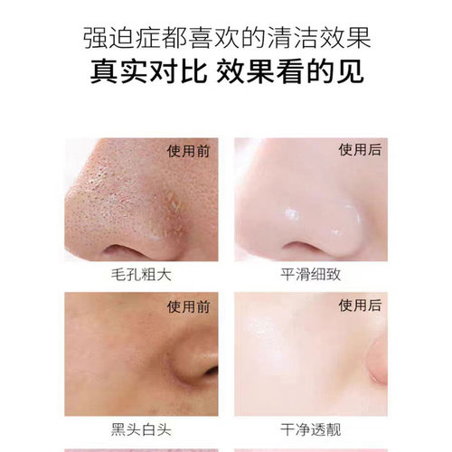 毛孔收缩精华液收缩毛孔粗大修复收敛湿敷爽肤水男女士去黑头闭口 - 图0