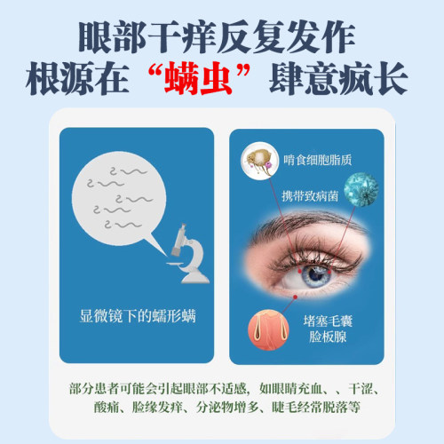 茶树精油眼部除螨湿巾眼贴去螨虫4四松油醇棉片专用清洁眼睛干痒 - 图0