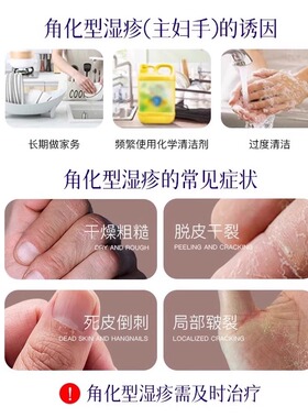 【阿里药房直营】肝素钠膏TOP!