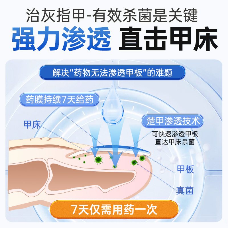 楚甲盐酸阿莫罗芬搽剂脚气灰指甲正品专用药旗舰店甲癣抗真菌 - 图3