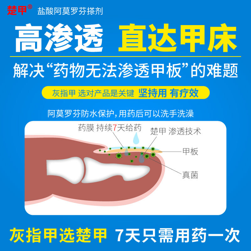 盐酸阿莫罗芬搽剂1.5 ml正品专用药 阿里健康大药房癣症