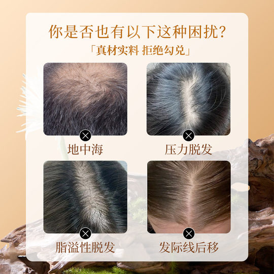 侧柏叶洗发皂防脱生发何首乌中药天然手工皂固发控油植物养发皂