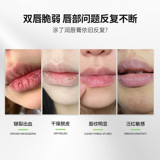 凡士林维生素原B5唇部精华油滋润保湿补水去防干裂死皮淡化唇纹