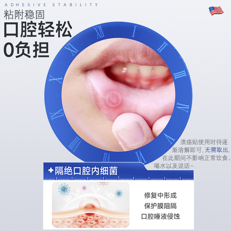 口腔溃疡贴片儿童嘴巴上火起泡烂口腔溃疡一口贴壳聚糖西瓜霜,淘宝优惠券,粉丝福利购,淘宝优惠卷