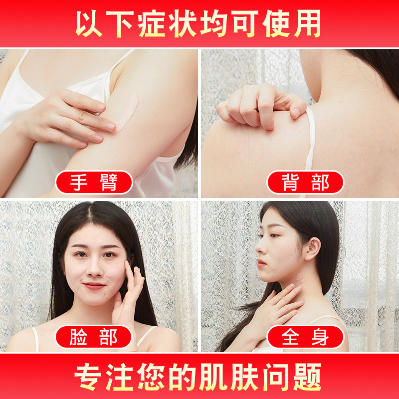  逐爱堂成人用品皮肤消毒护理（消）