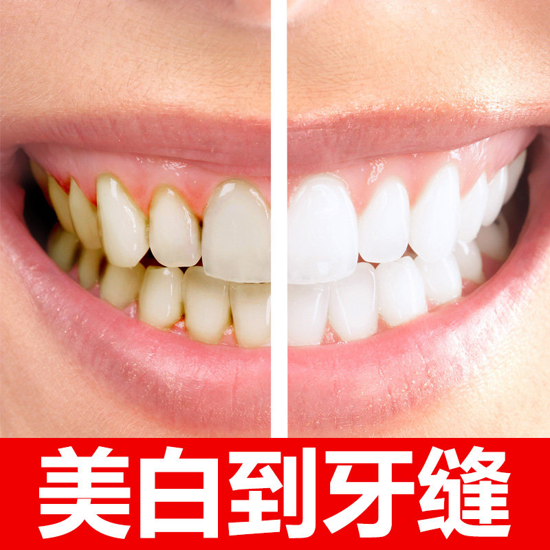 去黄牙神器去烟牙黑渍牙斑净液牙膏 霸克牙粉