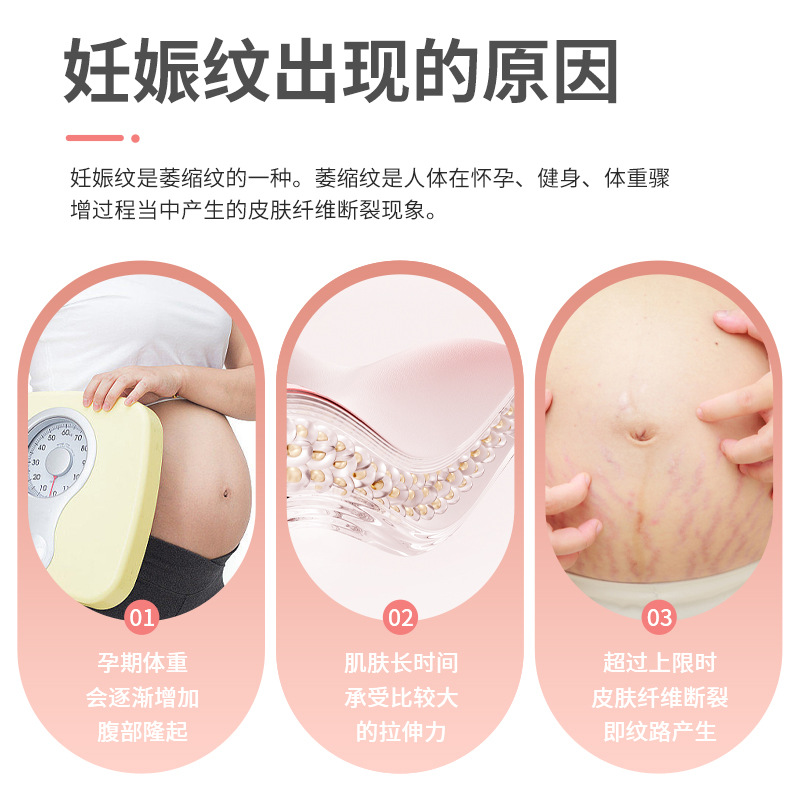 妊娠纹修复霜产后修复去除妊娠纹紧致肚皮淡化除疤痕孕妇专用膏-图0