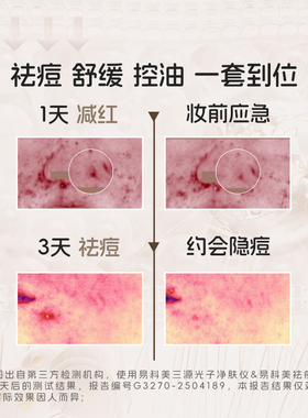 易科美祛痘舒缓精华液