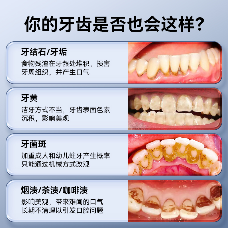 德国碧乐士可视牙结石去除器超声波洗牙器洗牙齿污垢除牙石洁牙仪 - 图0