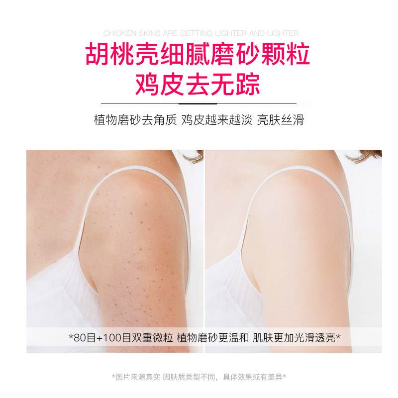 烟酰胺玫瑰去鸡皮去角质毛囊磨砂膏 慕漾鑫力达盛身体磨砂